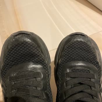 Skechers Ayakkabı 3 Ayda Yanlardan Ve Önden Açıldı.