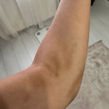 Özel Medar Hastaneleri Mağduriyet Yaşama