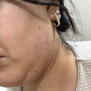 Sephora Cildim Tahriş Oldu