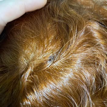 Palette Kafa Derisi Ve Saç Yanma