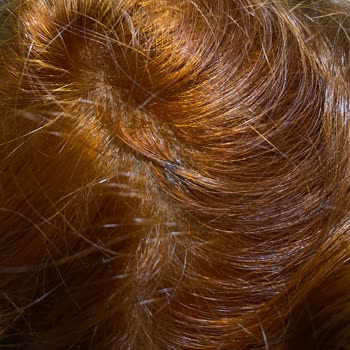 Palette Kafa Derisi Ve Saç Yanma