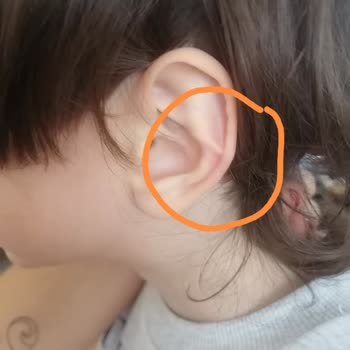 Gülümse Anaokulu Sınıflardaki Sandalyelerdeki Güvenlik Problemi.