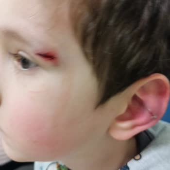 Gülümse Anaokulu Sınıflardaki Sandalyelerdeki Güvenlik Problemi.