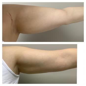 Gözde Gizem Beauty & Wellness Kolumu Mahvettiler Ücret İadesi Yapmıyorlar!