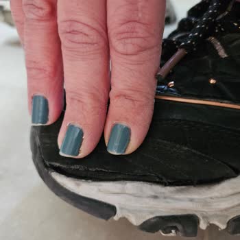 Skechers Spor Ayakkabılarımın Kısa Sürede Açılması Yıpranması