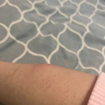 Bingo Matik Leke Tanıma + Anti-aging