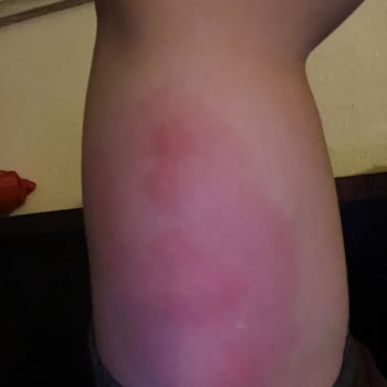 Bingo Matik Leke Tanıma + Anti-aging