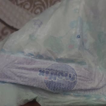 Molfix Sızdırıyor Ve Topan Topan Kabarıyor