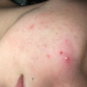 La Roche Posay Eczanede Sahte Ürün Mü Satıyor