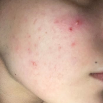 La Roche Posay Eczanede Sahte Ürün Mü Satıyor