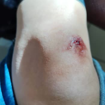 Salomon Ayakkabı Ayakkabının Kayması Nedeni İle İade