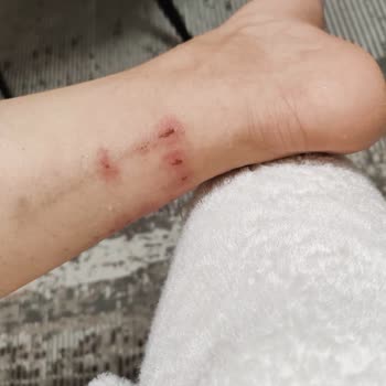 Salomon Ayakkabı Ayakkabının Kayması Nedeni İle İade