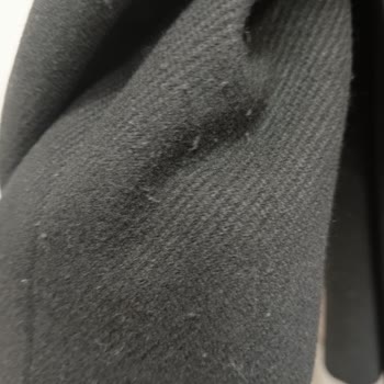 H&M Tüylenme Yapan Kase Kaban