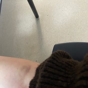 Özel Bilgi Hastanesi (Ankara) Tecrübesiz Ve İlgisiz Hemşireler