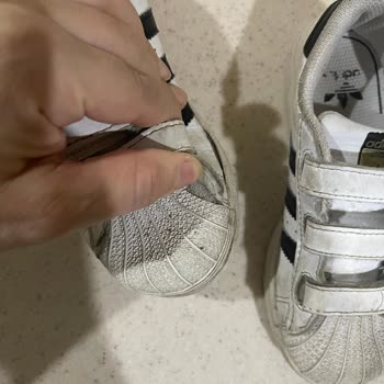 Adidas Ayakkabı 4 Aylık Kenarları Payladı