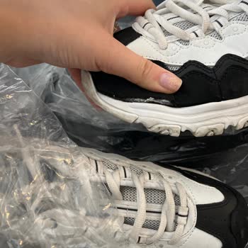 Skechers Dlites Koleksiyon Ayakkabım 9ay İçinde Açılıp Asla Yardımcı Olmamaları