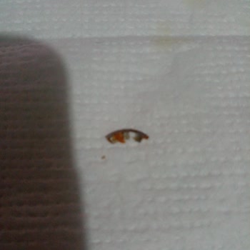 Erpiliç Tavuğundan Metal Parça Çıktı.