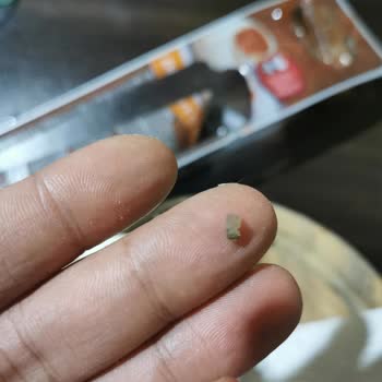 A101 Çiğköfteden Taş Çıktı