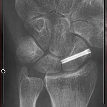 Kolan Hospital Yanlış Ameliyat Ve Tedavi