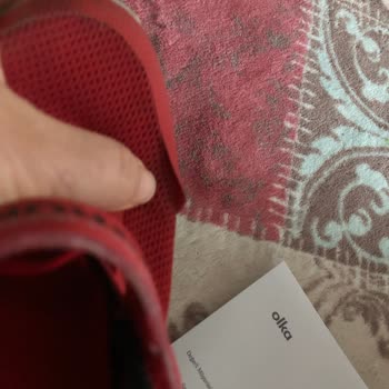 Skechers Markasının Sattıkları Ürünün Arkasında Durmaması