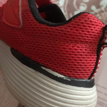 Skechers Markasının Sattıkları Ürünün Arkasında Durmaması