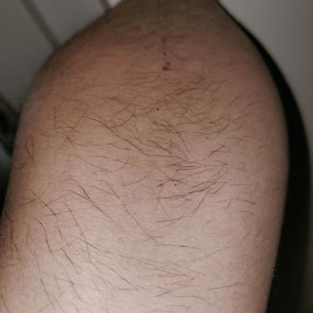 Suit Güzellik Merkezleri Çukurambar Memnuniyetsizlik Yaşama