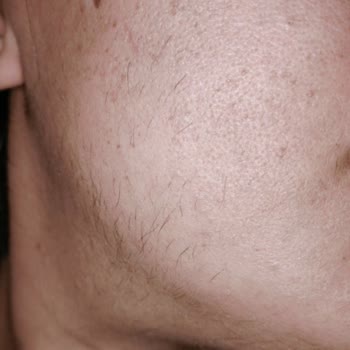 Suit Güzellik Merkezleri Çukurambar Memnuniyetsizlik Yaşama