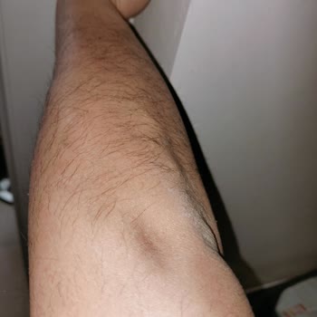 Suit Güzellik Merkezleri Çukurambar Memnuniyetsizlik Yaşama