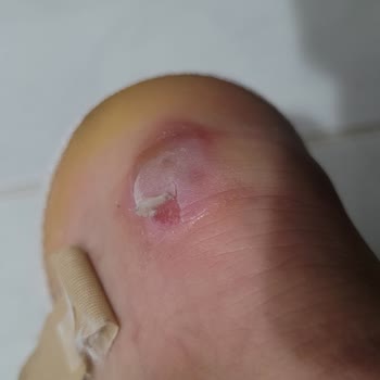 Torex FLO Ayakkabı Vurması Ve Ret Kararı