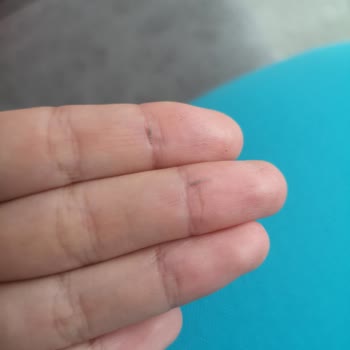 Bioderma Uyumsuz Ürüne Geri Dönüş Vermedi Müşteriyi Oyalıyor.