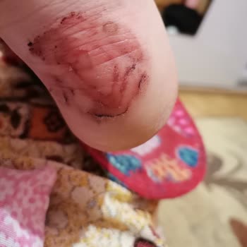 FLO Ayakkabı Ünlü Markanın Ayakkabısı Kullanımdan Sonra Sorun Yarattı, İade İşlemi Reddedildi