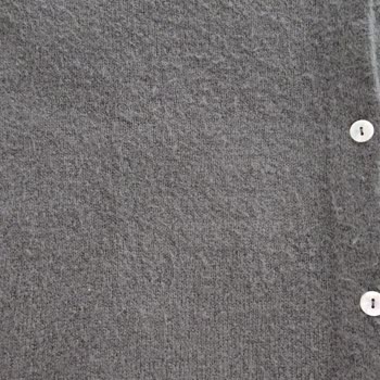 Özge Özgenç Butik Tüylenme Sorunu