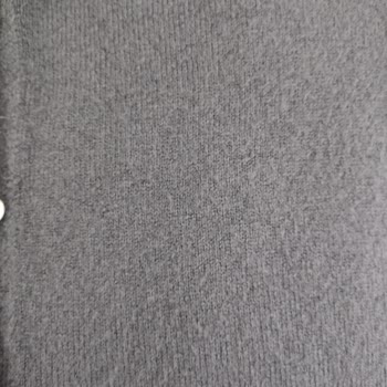 Özge Özgenç Butik Tüylenme Sorunu