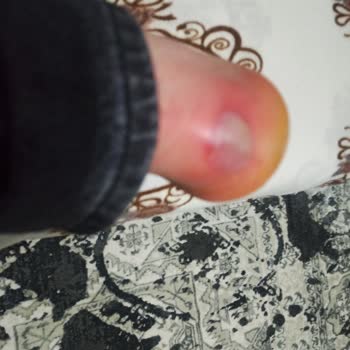 Ayakkabı Dünyası'nın Ürünü Ayağımı Yaraladı