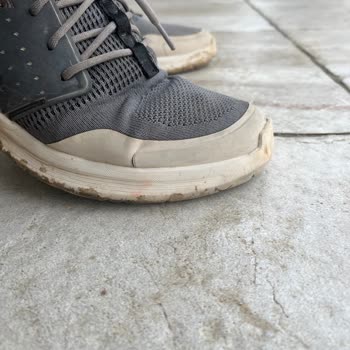 Skechers Yürürken Ayakkabım Yırtıldı