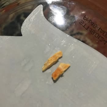 BİM Üründen Sert Cisim Çıkması