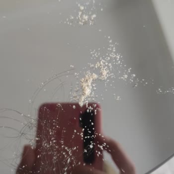 Clear Kepek, Yara Ve Dökülme Yapıyor