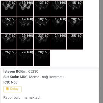 Mehmet Akif Ersoy Devlet Hastanesi MR Sonucum Belirtilen Tarihte Çıkmadı