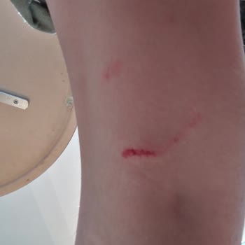 Mamak Belediyesi Köpek Saldırıları Çok Arttı