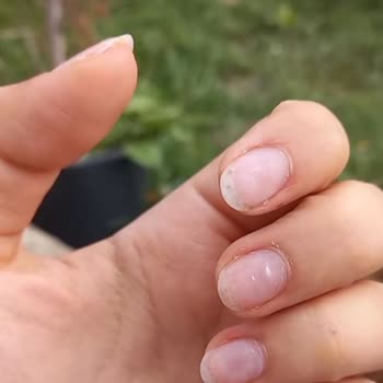 Aslızen Güzellik Merkezi Tırnaklarım Kırıldı Ve Mahvoldu