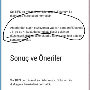 Türk Telekom Mağduriyeti Ve Haksız Yere Talep Edilen Fatura