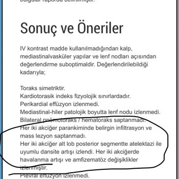 Unico Sigorta Kasko Hizmet Hayal Kırıklığı