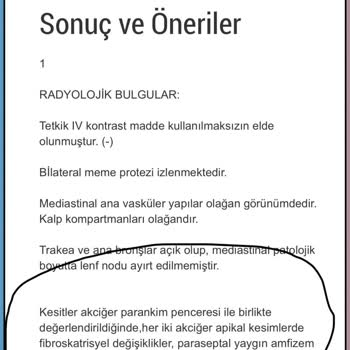 Unico Sigorta Kasko Hizmet Hayal Kırıklığı