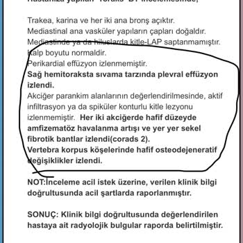 Unico Sigorta Kasko Hizmet Hayal Kırıklığı