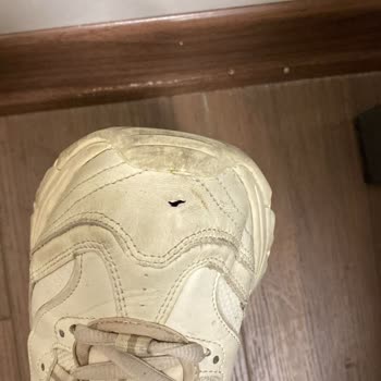 Skechers Ayakkabı 6 Ayda Yırtıldı. Ve Hatalarını Kabul Etmiyorlar.