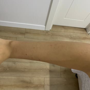 Urban Care Biotin Caffeine Şampuan Kafamda Ve Vücudumda Yaralar Yaptı