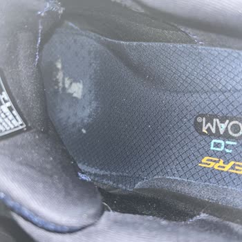 Skechers, Sorunlu Ürüne Müşteri Hatası Deyip Mağduriyetimi Gidermiyor!
