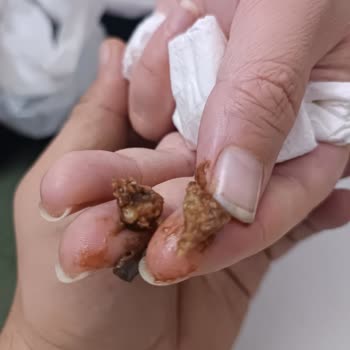 Ülker Çikolatalı Gofret İçinden Taş Gibi Bir Şey Çıktı