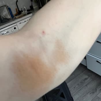 Medical Park Hastanesi Serum Takılma İşleminin Yapılamaması