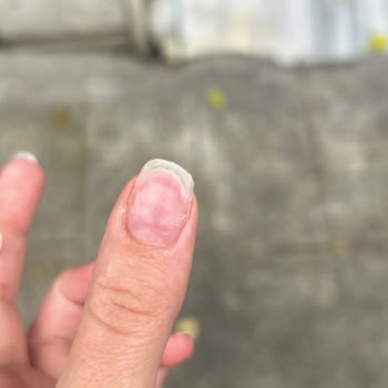 Büşra Yıldız Beauty Tırnak Çıkarma Gibi Basit Bir İşlemde Tırnaklarım Mahvoldu